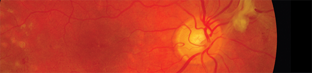 Clinical Neuro-Ophthalmology